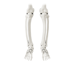 신경 근육성 질환 원인